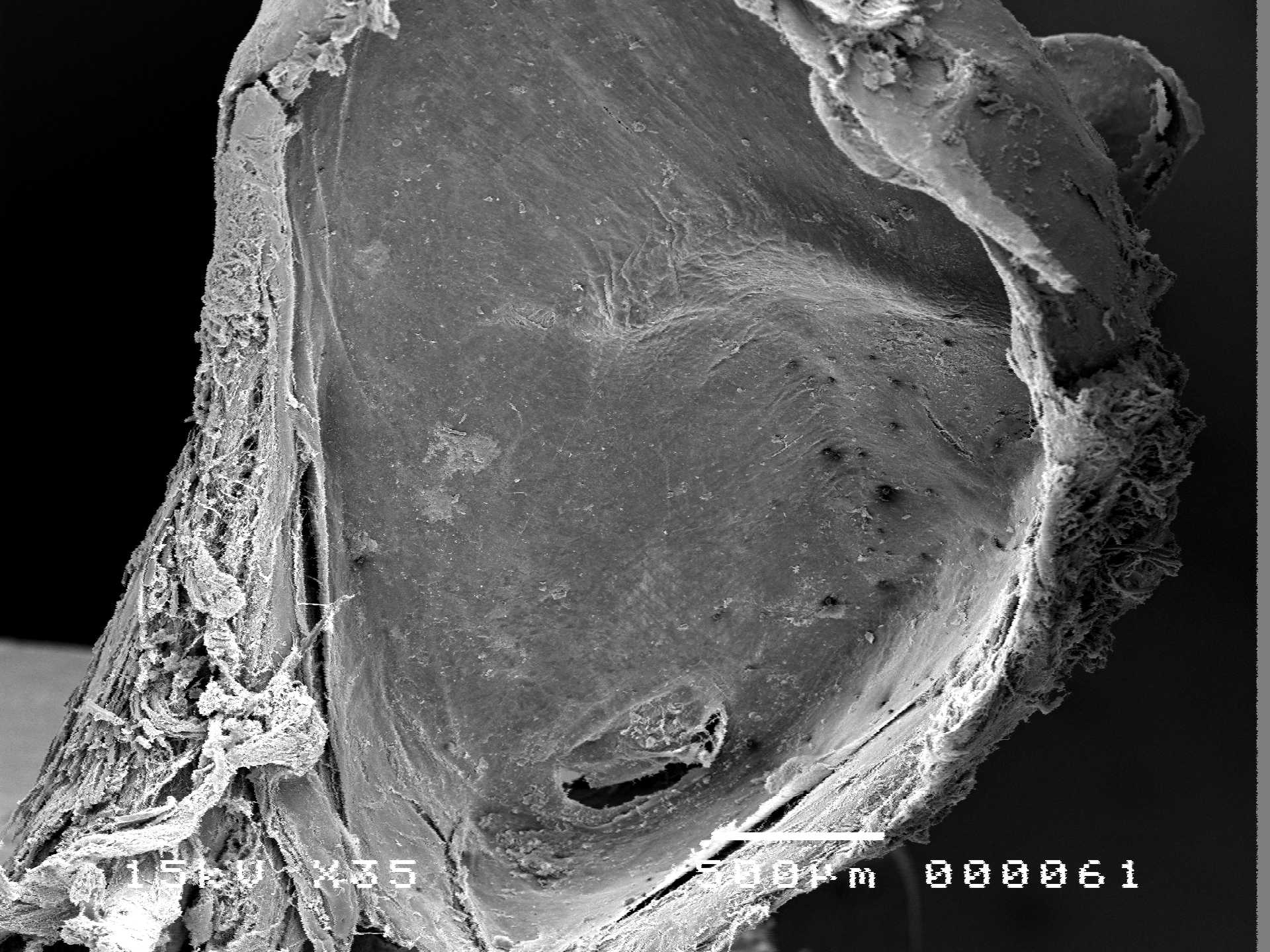 Scanning Electron Microscopy photo of the tympanum